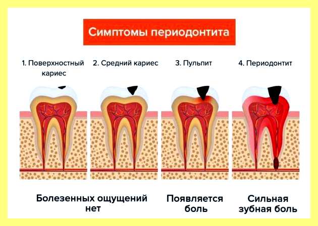 Что делать если протекает бойлер